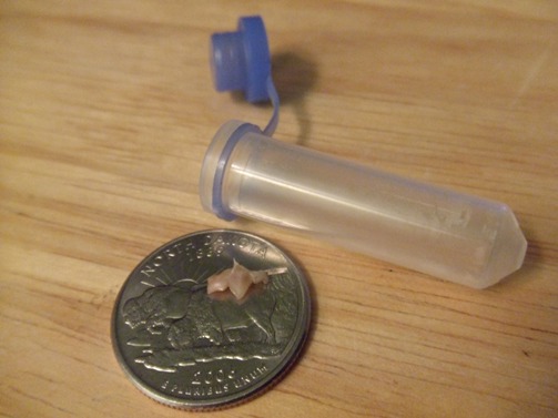 Baby tooth molar and super-cool vial they put it in.